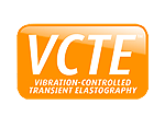 Технология VCTE